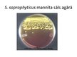 Prezentācija 'Staphylococcus saprophyticus baktērijas', 6.