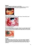 Referāts 'Redzes funkciju īpatnības dažādu acs pataloģiju gadījumos', 14.