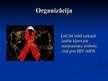 Prezentācija 'HIV un AIDS', 13.