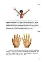 Referāts 'Matemātika un anatomija', 11.