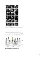 Referāts 'Hipertrofiskā kardiomiopātija', 19.