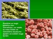 Prezentācija 'Biotehnoloģijas pārtikas rūpniecībā', 7.