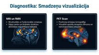 Prezentācija 'Enkefalīni', 19.