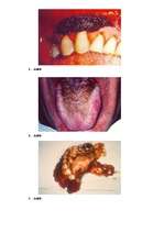 Referāts 'Smēķēšana jauniešu vidū', 24.