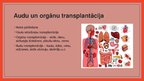 Prezentācija 'Transplantācija', 3.