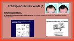 Prezentācija 'Transplantācija', 4.