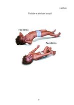 Diplomdarbs 'Zobārstniecības poliklīnikas ārstu un māsu informētība par epilepsiju', 47.