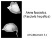 Prezentācija 'Aknu fasciolas', 1.