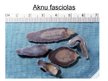 Prezentācija 'Aknu fasciolas', 9.