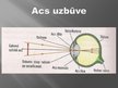 Prezentācija 'Acs uzbūve un redzes problēmas', 2.