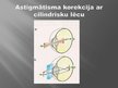 Prezentācija 'Acs uzbūve un redzes problēmas', 11.