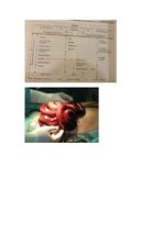 Konspekts 'Ileuss', 3.