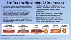 Prezentācija 'Perkutāna translumināla angioplastika', 2.