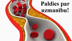 Prezentācija 'Perkutāna translumināla angioplastika', 9.
