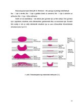 Prezentācija 'Kuņģa karcinoma', 11.