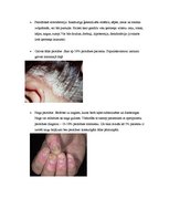 Konspekts 'Psoriāzes patoģenēze, klīniskās izpausmes un ārstēšana', 4.