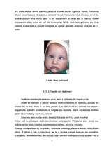 Referāts 'Acu aizsardzība un veselīga uztura ietekme uz redzi', 6.