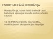 Prezentācija 'Pacienta fizikālā stāvokļa novērtēšana. Elpceļi', 48.