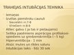 Prezentācija 'Pacienta fizikālā stāvokļa novērtēšana. Elpceļi', 53.