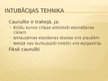 Prezentācija 'Pacienta fizikālā stāvokļa novērtēšana. Elpceļi', 55.