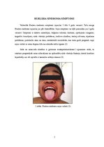 Referāts 'Hurlera sindroms', 7.