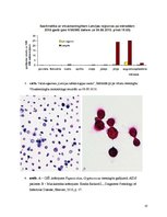 Referāts 'Aseptisks meningīts', 10.