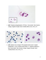 Referāts 'Aseptisks meningīts', 11.