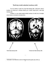 Referāts 'Tiesu psihiatrijas un tiesu psihiatrisko ekspertīžu būtība un nozīme', 28.
