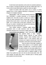 Referāts 'Ortozēšanas iespējas apakšstilba kaulu osteomielīta izraisīto ortopēdisko traucē', 21.