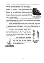 Referāts 'Ortozēšanas iespējas apakšstilba kaulu osteomielīta izraisīto ortopēdisko traucē', 26.