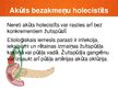 Prezentācija 'Akūts holecistīts', 7.