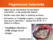 Prezentācija 'Akūts holecistīts', 11.