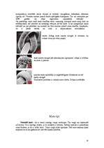 Referāts 'Mati', 14.