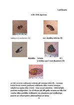 Prakses atskaite 'Māsas loma melanomas slimības profilaksē', 20.