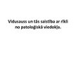 Prezentācija 'Vidusauss un tās saistība ar rīkli no patoloģiskā viedokļa', 1.