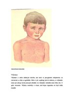Konspekts 'Bērnu slimības', 4.
