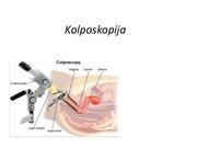 Prezentācija 'Izmeklēšanas metodes ginekoloģijā', 22.