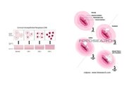 Prezentācija 'Izmeklēšanas metodes ginekoloģijā', 33.