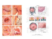 Prezentācija 'Izmeklēšanas metodes ginekoloģijā', 34.