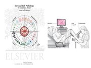 Prezentācija 'Izmeklēšanas metodes ginekoloģijā', 35.