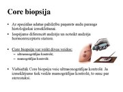 Prezentācija 'Izmeklēšanas metodes ginekoloģijā', 51.