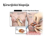 Prezentācija 'Izmeklēšanas metodes ginekoloģijā', 53.