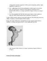 Referāts 'Bilirubīna metabolisms un neirotoksicitāte jaundzimušajiem', 6.