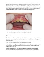 Referāts 'Bilirubīna metabolisms un neirotoksicitāte jaundzimušajiem', 7.