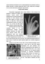 Referāts 'Rentgenattēlu iegūšana ar tumšā lauka metodi', 3.