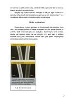 Referāts 'Rentgenattēlu iegūšana ar tumšā lauka metodi', 8.