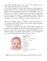 Referāts 'Hromosomālie sindromi, to raksturojums', 6.