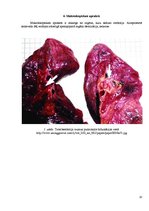 Konspekts 'Embolija', 10.