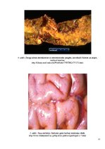 Konspekts 'Embolija', 12.