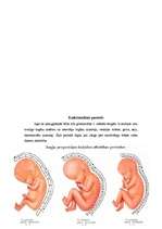 Referāts 'Grūtniecība', 16.